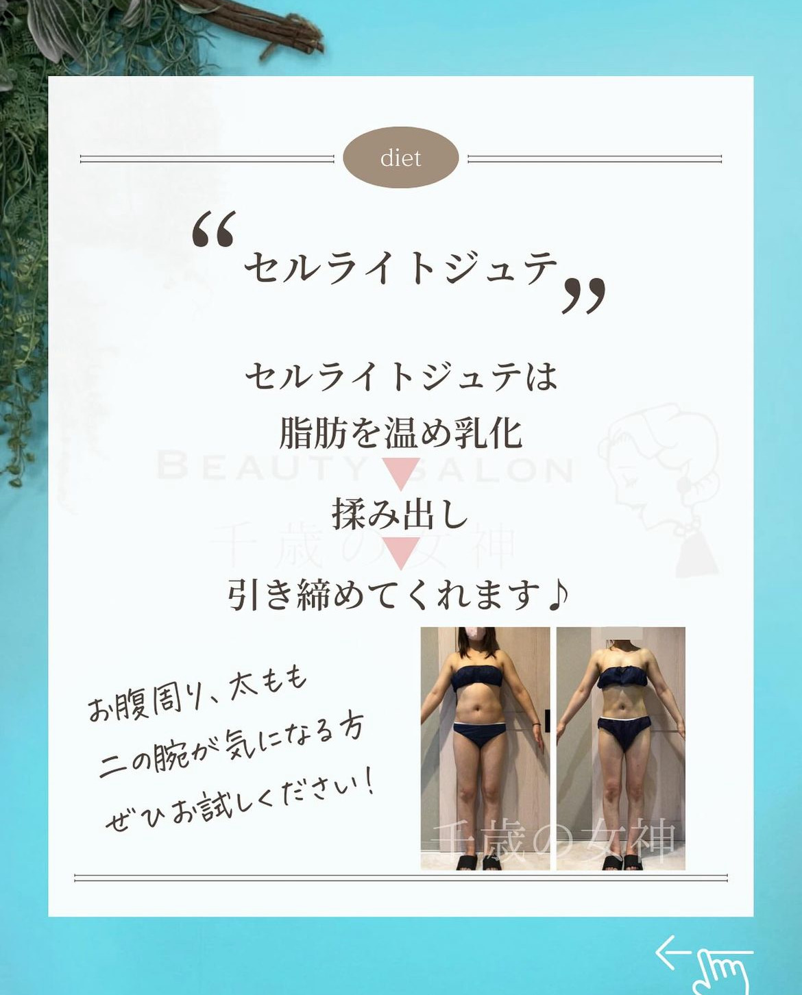 岡崎市・西尾市・安城市・銀座・豊橋市のフェイシャルエステ千歳の女神の痩身機器セルライトジュテのビフォーアフター画像