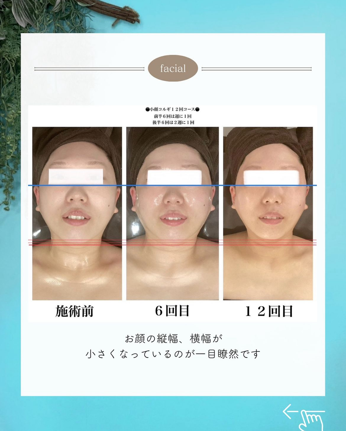 岡崎市・西尾市・安城市・銀座・豊橋市のフェイシャルエステ千歳の女神の首の老廃物やコリが取れて鎖骨がすっきり画像